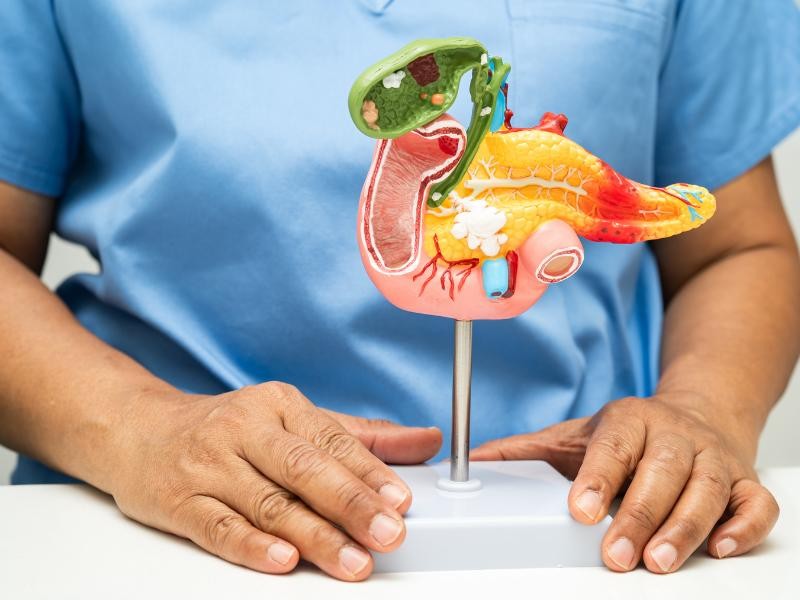 Câncer de Pâncreas: Entenda a Doença, Fatores de Risco e Formas de Tratamento