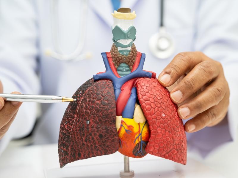 Câncer de Pulmão: Sintomas que Podem Passar Despercebidos