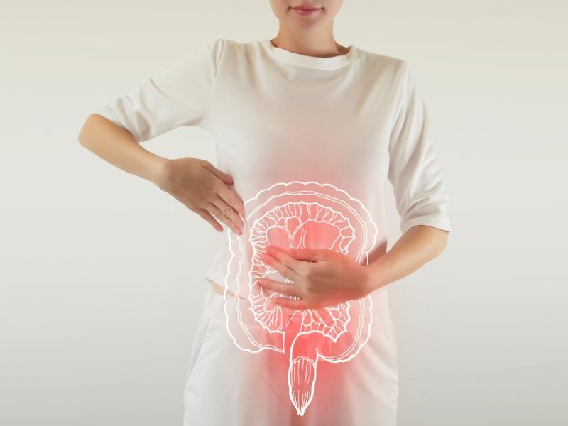 DOENÇA INFLAMATÓRIA INTESTINAL: ENTENDA O QUE É AS DOENÇAS INFLAMATÓRIAS INTESTINAL