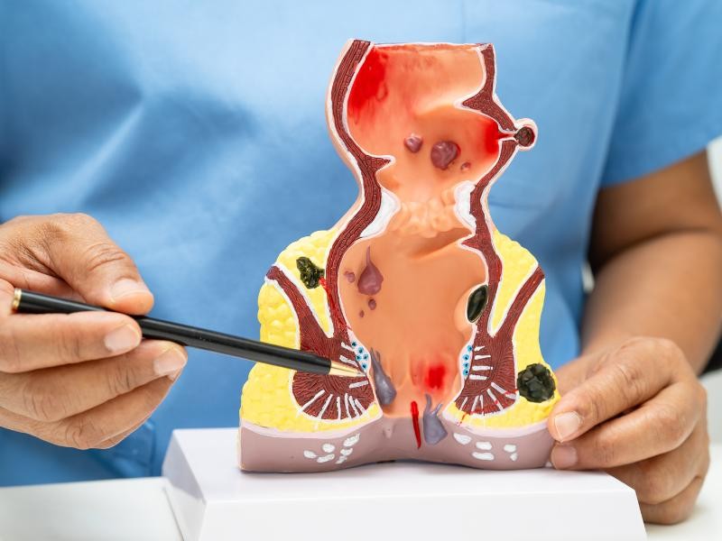 Consulta Proctologista